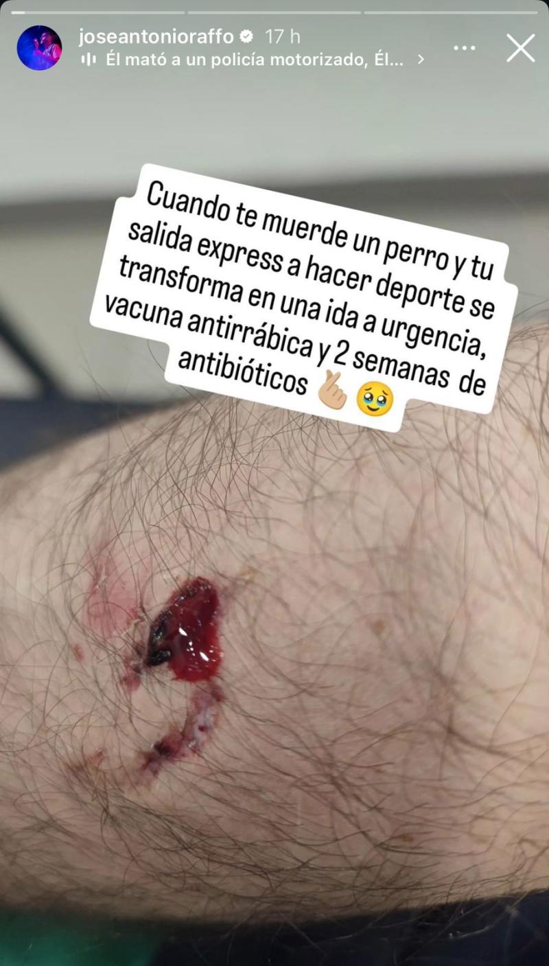 Instagram - José Antonio Raffo y la mordida que le hizo el perro