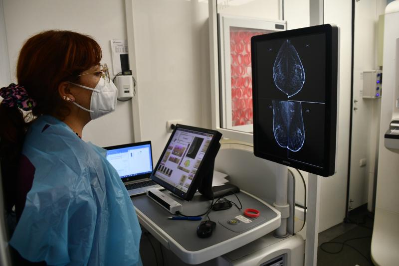 Agencia Uno - Inteligencia artificial puede identificar a mujeres con riesgo elevado de cáncer de mama