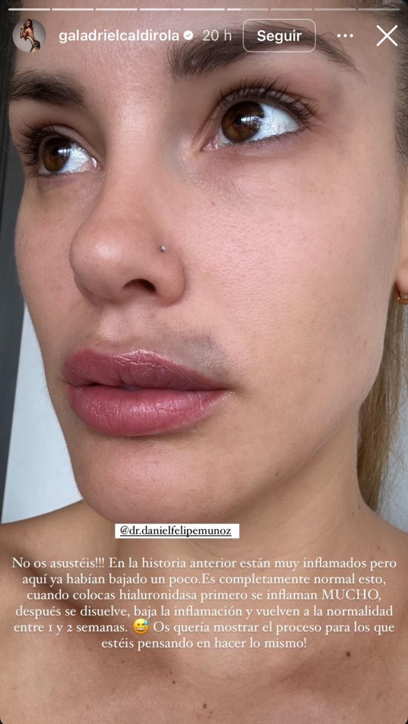 Instagram - Gala Caldirola