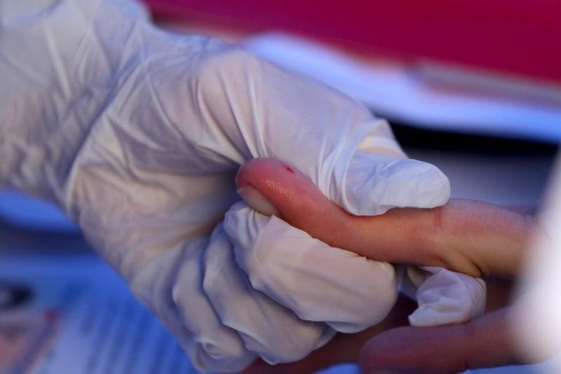 Agencia Uno - Test rápido de VIH