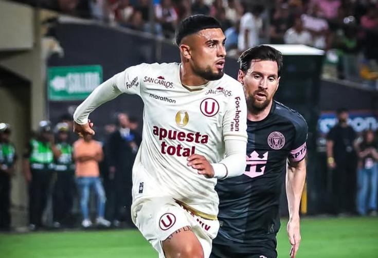 Ex U de Chile recibe fuerte pisotón en la mano - Créditos: Instagram