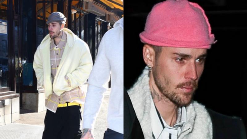 X - Justin Bieber preocupa a sus seguidores por su descuidado aspecto