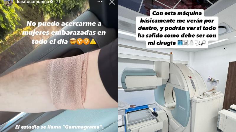Instagram - Luisito Comunica se somete a tratamiento con material radioactivo