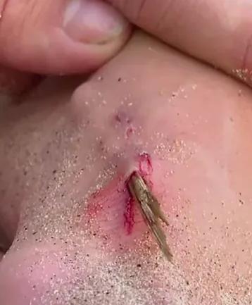 captura - "Cualquier persona estaría llorando": La impactante lesión que sufrió Gala Caldirola en el reality "Supervivientes"