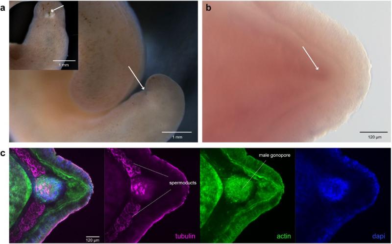 Gonoporos de los Xenoturbella bocki macho, animales estudiados en la investigación sobre el origen del ano