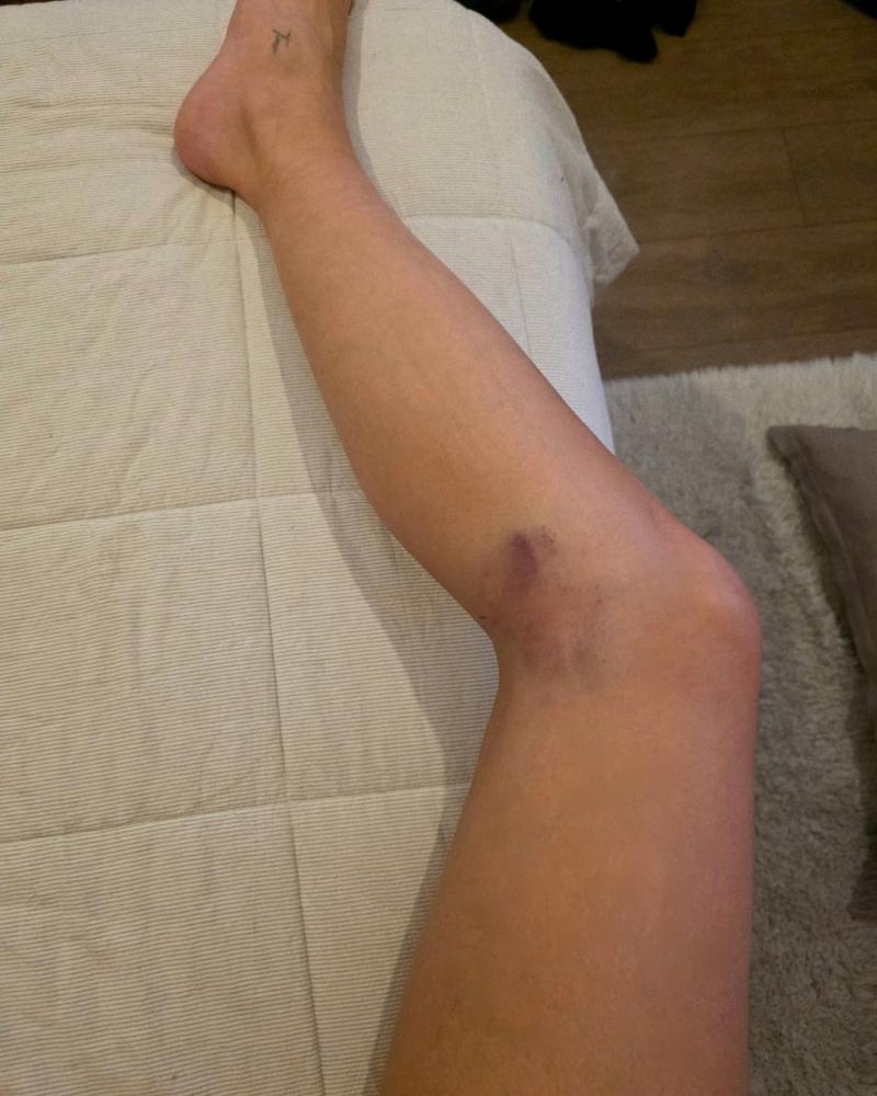 Instagram - Kel Calderón