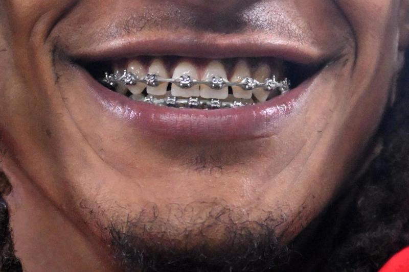 Dientes - AFP referencial