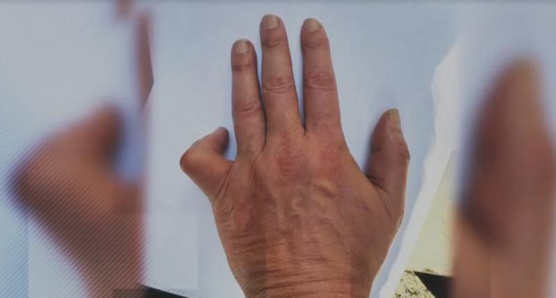 Ex boxeador Carlos Cruzat denuncia que lleva más de un año sin recibir pensión de gracia