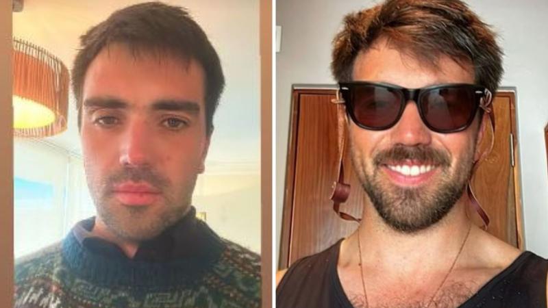 Redes sociales - Sujeto es acusado de haber golpeado a conserje de 70 años