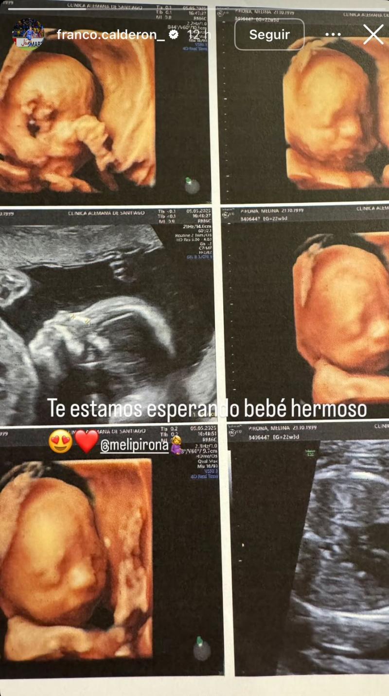 Franco Calderón, jugador de U de Chile, anunció que se convertirá en padre - Créditos: Captura