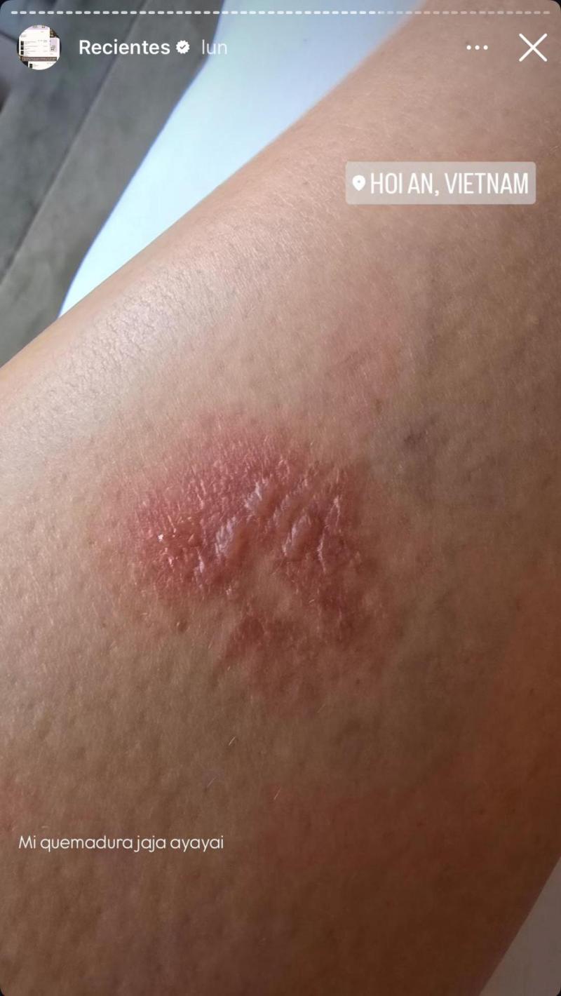 Instagram - Kel Calderón