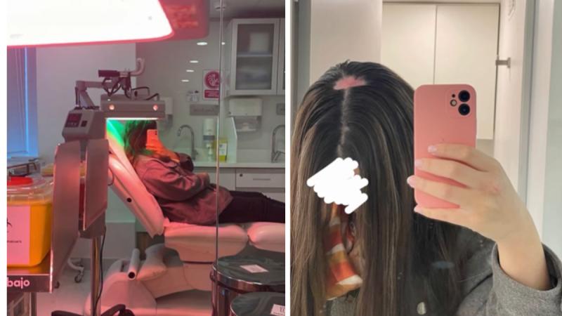 Joven que denunció a peluquería no podrá recuperar su pelo - Instagram @peluqueriamall