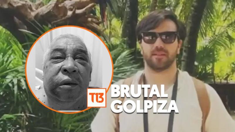 T13 - "El ojo, al parecer, se perdió al 100 por 100": Conserje agredido por empresario en Vitacura sufre terrible diagnóstico