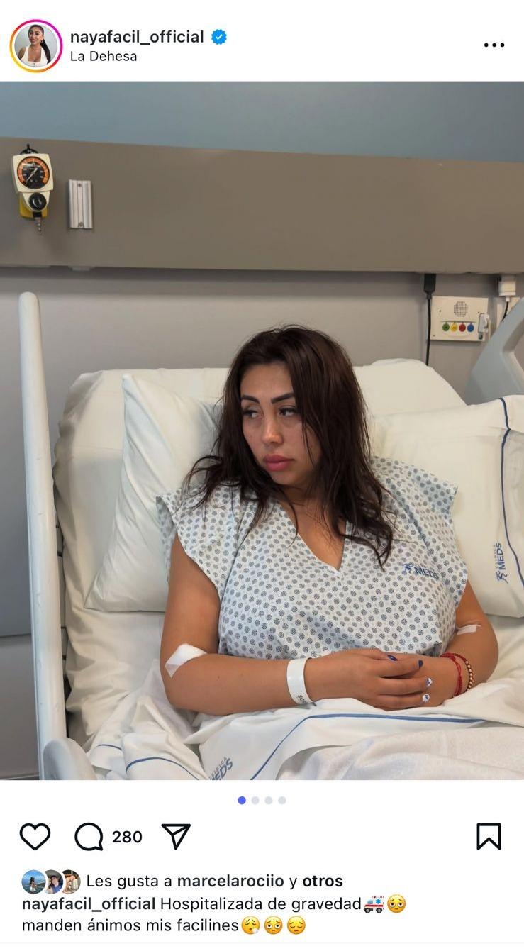 Naya Fácil contó que fue hospitalizada de gravedad por bacteria en un riñón