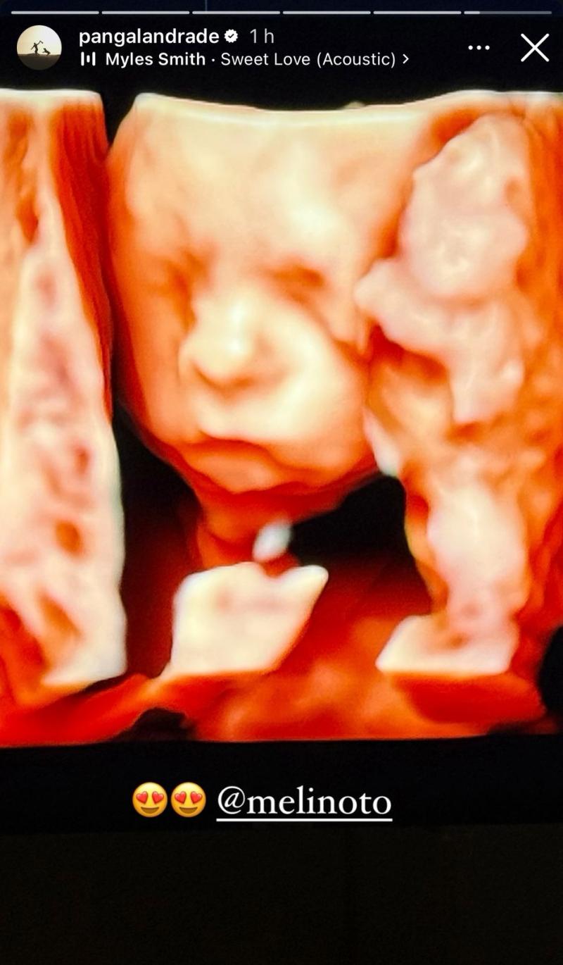 Instagram - Bebé de Pangal Andrade y Melina Noto