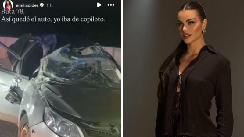 Emilia Dides muestra sus cicatrices tras accidente automovilístico - Instagram