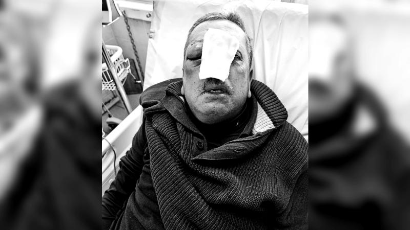 T13 - Chofer de micro sufre brutal golpiza en Villa Alemana