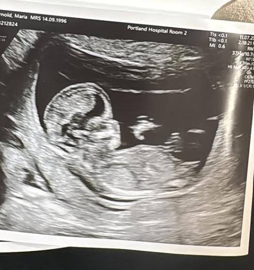 Ecografía - Francisco Sierralta vía Instagram