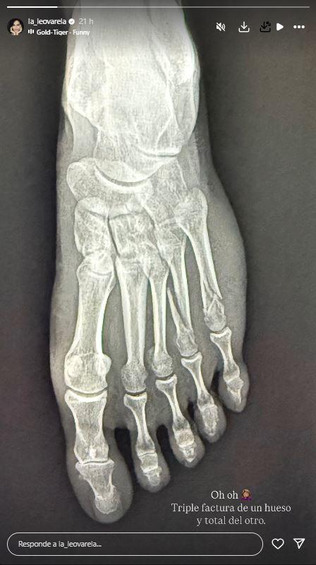 Captura - Accidente de Leonor Varela