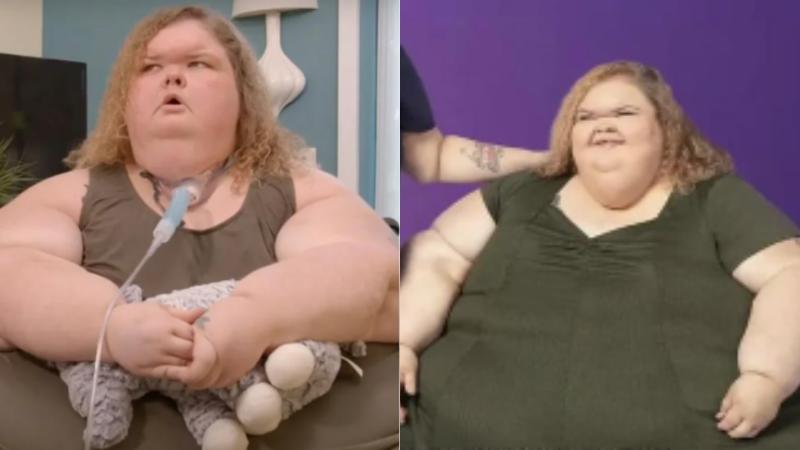 TiKTok - Redes Sociales - Paciente de Kilos Mortales muestra impactante cambio tras cirugía de extracción de piel por bajar más de 220 kilos