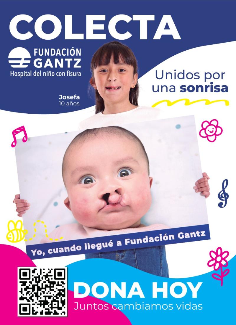 Fundación Gantz - Labio leporino