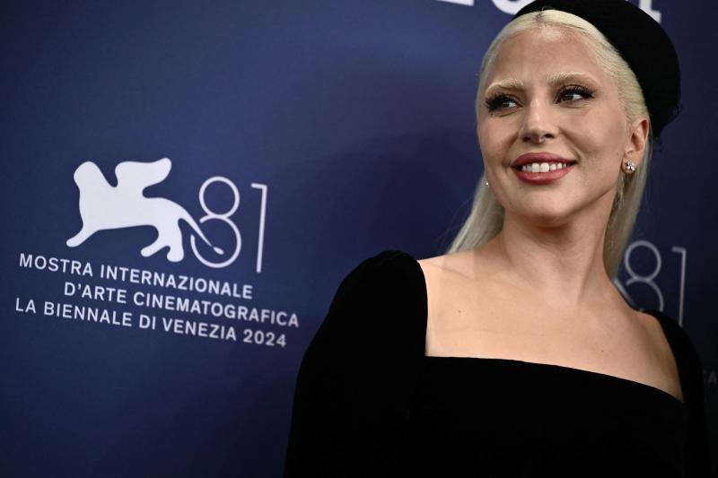 AFP - LADY GAGA - Día del zurdo: Los famosos que no sabías que son zurdos | T13
