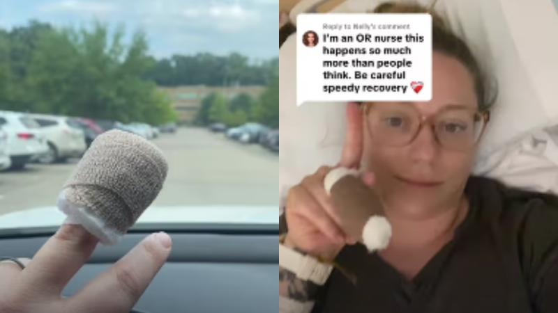 TikTok - Mujer fue hospitalizada y operada de urgencia por arañazo de su gato: infección derivó en riesgo cardiaco