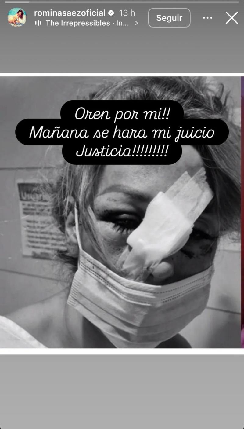 Instagram - Romina Sáez