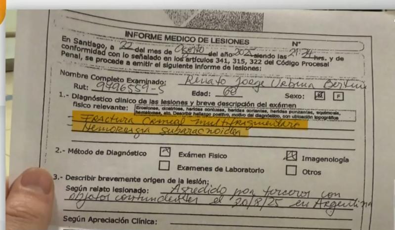 Hincha de la U fue dado de alta en Argentina, llegó a Chile y tenía delicada fractura de cráneo