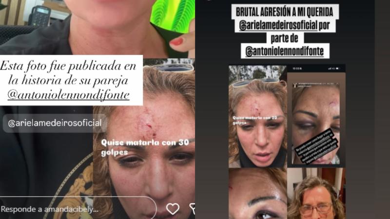 Instagram - Exbailarina de Axé Bahía, Amanda Cibeli, denuncia brutal agresión a exchica Mekano