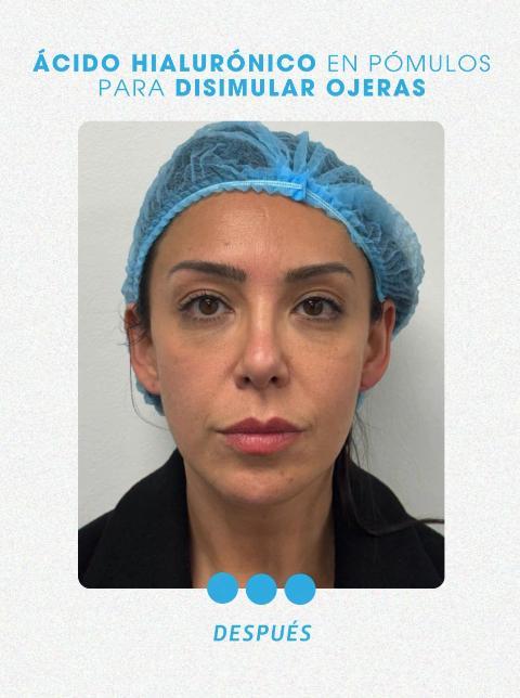 Captura - Cambio estético de Mariela Sotomayor