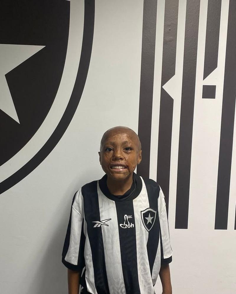 Instagram: @_bernardo_lopes11