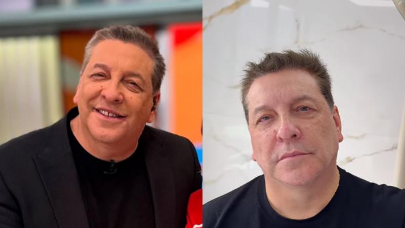 Instagram - Julio César Rodríguez sorprende con nuevo look tras someterse a armonización facial