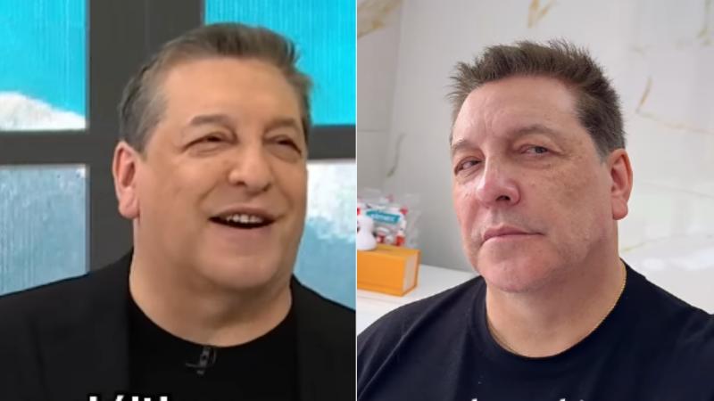Instagram - Julio César Rodríguez sorprende con nuevo look tras someterse a armonización facial