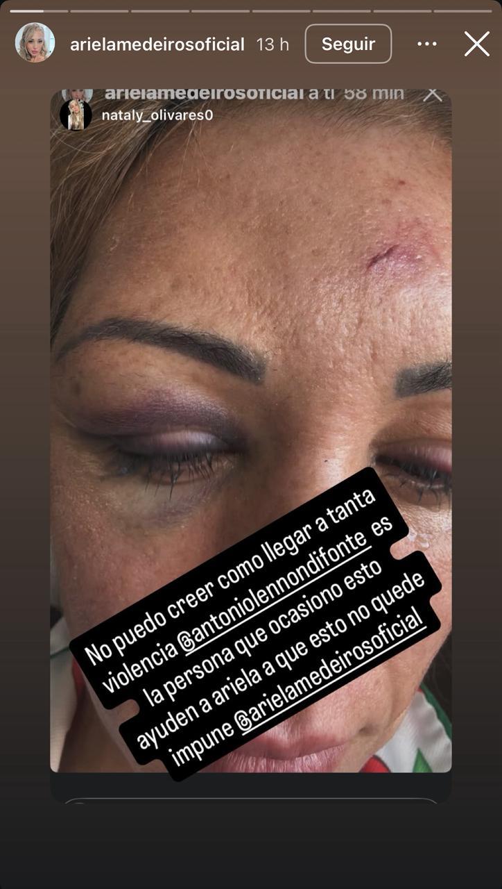 Instagram - Ariela Medeiros