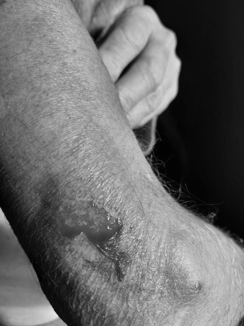 T13 - Hijo agrede a su madre y su marido en Quillota