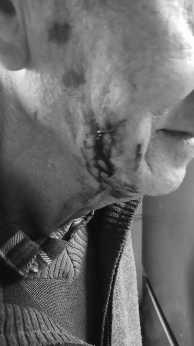 T13 - Hijo agrede a su madre y su marido en Quillota