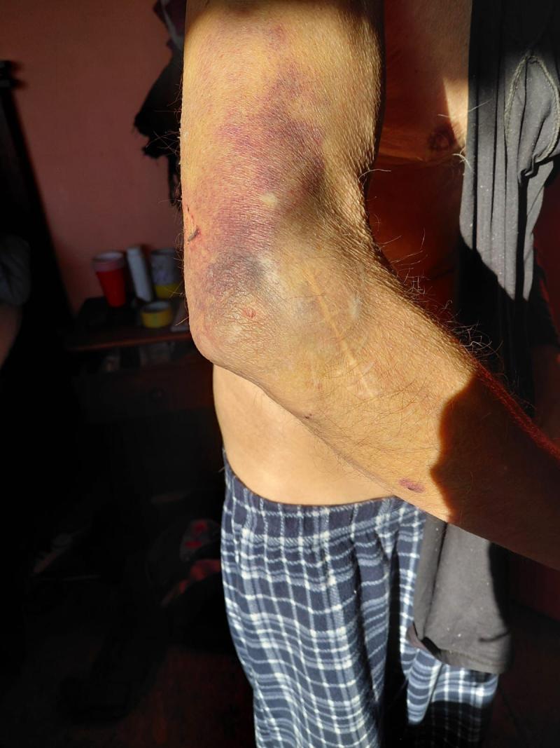 T13 - Hijo agrede a su madre y su marido en Quillota