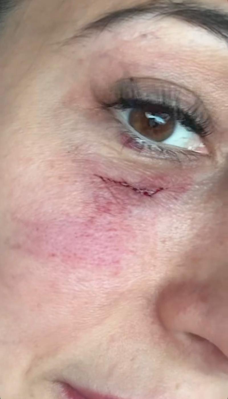 Instagram - Rebeca Naranjo, pareja de Nano Calderón