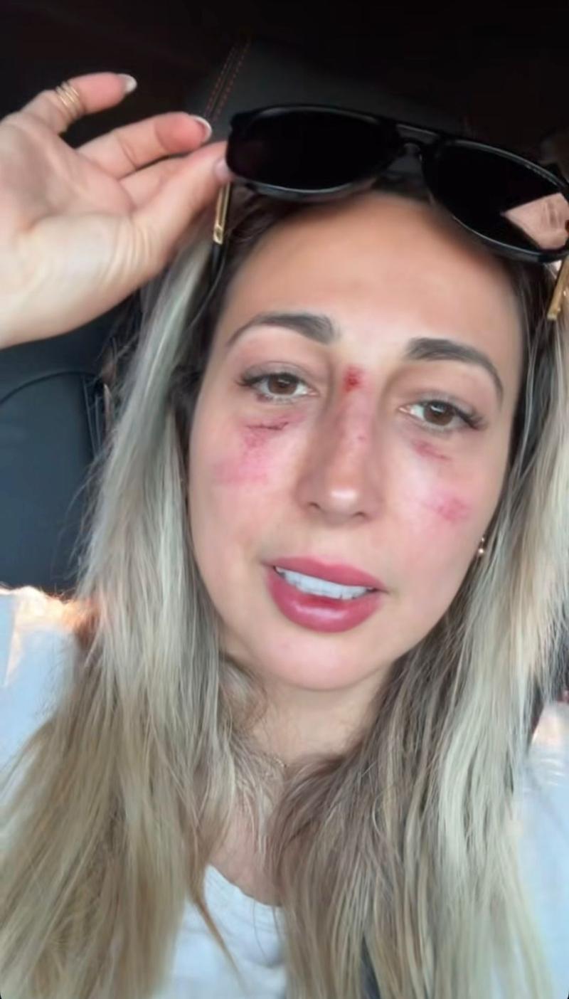 Instagram - Rebeca Naranjo tuvo accidente en moto