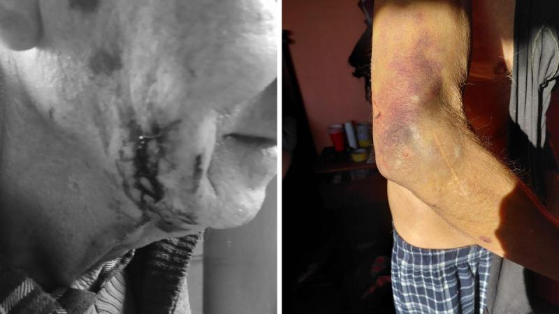 El relato de la madre que solicita ayuda para internar a su hijo - T13