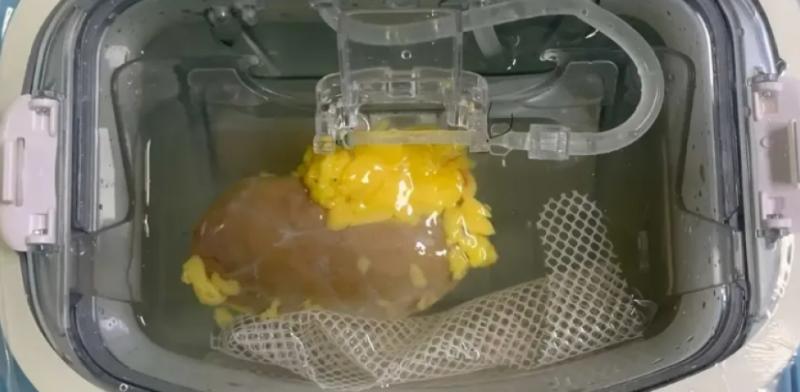 Adiós al rechazo de órganos: científicos logran crear el primer riñón “universal” compatible con cualquier persona - Nature Biomedical Engineering