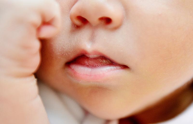 Agencia Uno (referencial) - Caída de pelo post parto