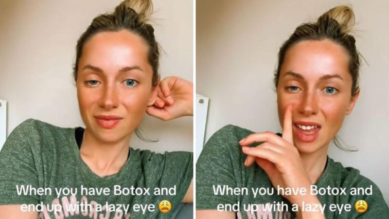 Captura TikTok - Resultados del bótox no fue el esperado