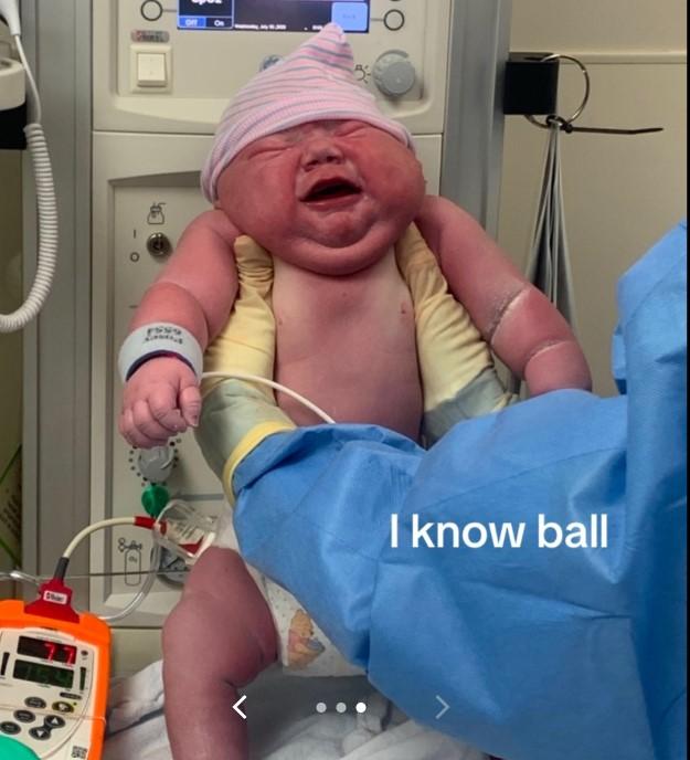 Tiktok - Mujer reveló la impactante imagen del nacimiento de su bebé que pesó casi 6 kilos