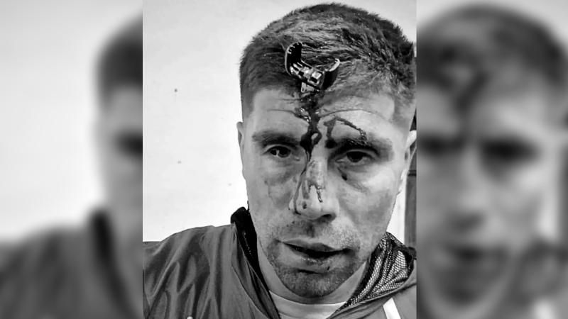 TyC Sports - Jonathan Smith terminó con una llave enterrada en el cráneo