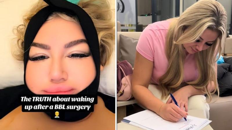 Captura TikTok - Influencer se sometió a 6 cirugías y se arrepintió al día siguiente