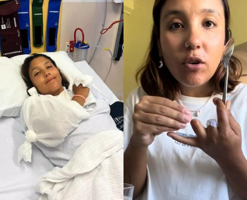 Chilena relata cómo perdió dos dedos mientras hacía clases de buceo en Australia: "La saqué y mis dedos ya no estaban” - RRSS