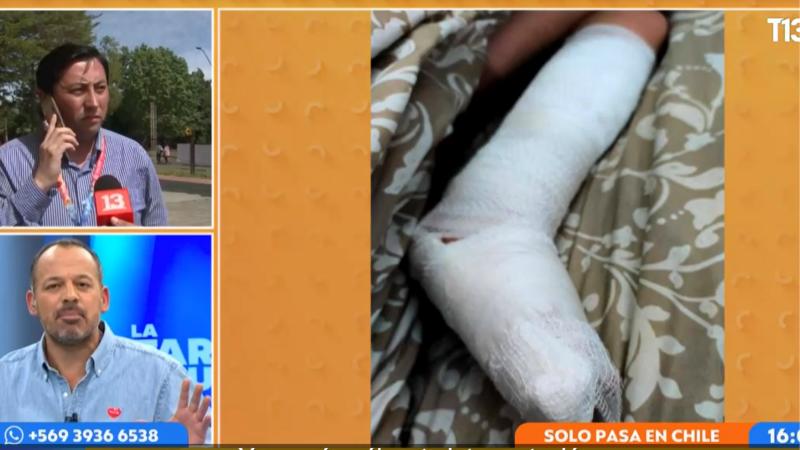 LTN - Solo pasa en Chile: menor que sufrió fractura de peroné fue inmovilizado con un cono de cartón en el SAR