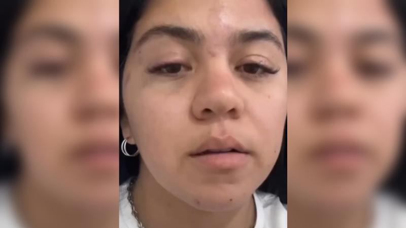 Instagram - Venezolana denuncia brutal golpiza tras altercado con vendedor en la Vega